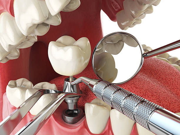 Best Emergency Dental Care for Sports Injuries in Coing, AL